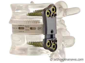 Zavation Medical Products, LLC. Launches Z-Span Expandable Anterior And Lateral Lumbar Plates - OrthoSpineNews