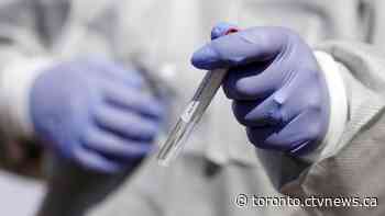 Ontario records fewer than 100 new COVID-19 cases for first time in four months