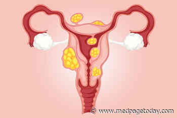 Myomectomy Edges Embolization for Uterine Fibroids