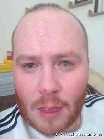 Man remanded in custody over acid attack on St Helens dad-of-three - St Helens Star