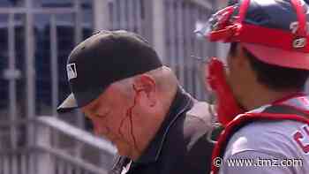 MLB Ump Joe West Bloodied After Accidental Bat To Head, Returns After Stitches