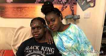 Family of racist attack victim pledge to stay in 'fantastic Bristol'