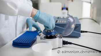 Alberta adds 127 COVID-19 cases, 1 death