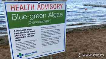 Alberta Health Services issues water quality advisory for Sturgeon Lake park