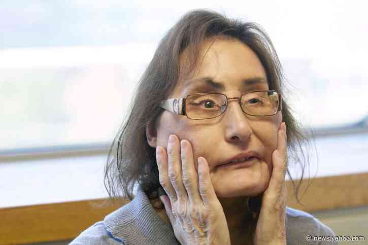 Connie Culp, 1st US partial face transplant recipient, dies