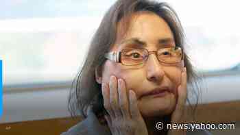 Connie Culp, 1st US partial face transplant recipient, dies