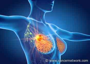 Study Suggests 86-SNV Be Incorporated in Breast Cancer Risk Predication Models - Cancer Network