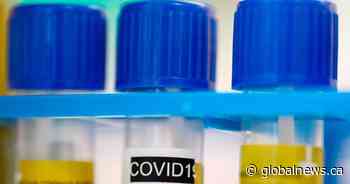 17 new cases of coronavirus reported in Saskatchewan and 19 recoveries