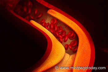 Troponin Could Help Determine Lipid Tx in Stable Patients