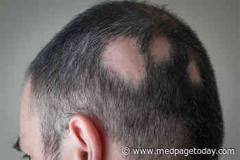 New Insights Into Radiation-Induced Hair Loss