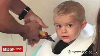 Bristol toddler gets head stuck in toilet seat