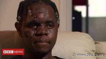 K-Dogg: Fourth arrest over racist attack on musician