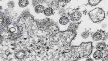 Sask. reports 19th COVID-19 related death