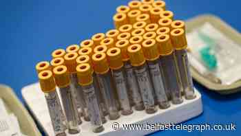 174 new cases of coronavirus notified in Ireland
