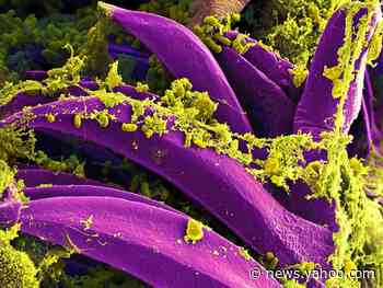 A man in his 20s died of the plague in New Mexico's first reported death from the infection in years