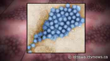 Suspected norovirus outbreak closes Algonquin Park resort