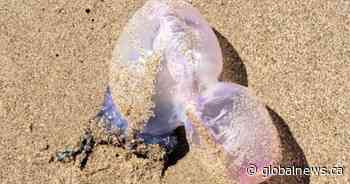 7-year-old stung by Portuguese man o' war on Lawrencetown Beach - Global News