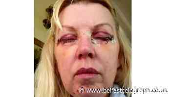 Woman’s relief after surgeon struck off following botched cosmetic procedure