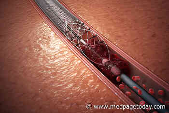 Better Outcomes Seen with Thrombectomy Even Long After Stroke Onset