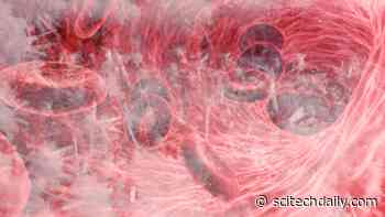 Immune-System Paralyzed in Severe COVID-19 Cases