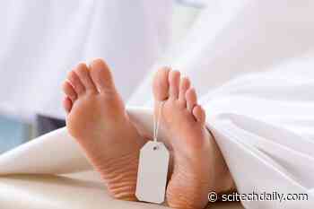 Opioid Overdose Deaths May Be Grossly Underestimated: Many Found to Be Misclassified As Sudden Heart Attacks