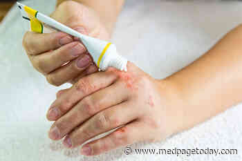 Calcineurin Blockers for Eczema: No Cancer Signal in Big Study