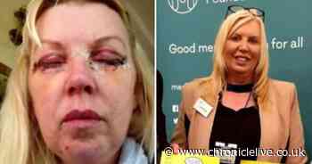 Stanley woman's relief after doctor struck off following botched eye surgery - Chronicle Live