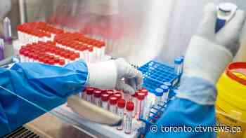 Ontario records decline in new COVID-19 cases but says numbers are underestimated
