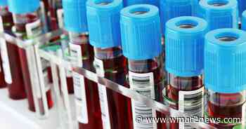 Maryland lab believes they have promising HIV cure, will start Baltimore trials in September - wmar2news.com