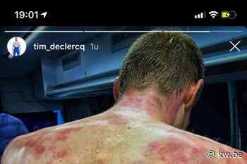 Wat een wielrenner al niet lijden kan... Tim Declercq slachtoffer van hagelbui