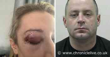 Walker mum glassed in face by ex boyfriend breaks silence