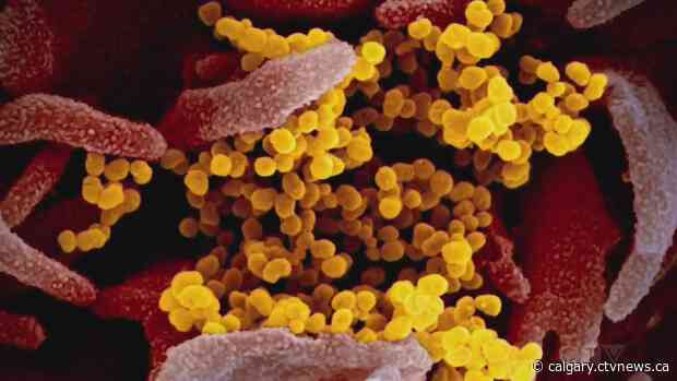 3 new COVID-19 outbreaks declared in Calgary