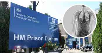 HMP Durham brings in X-ray body scanners in crackdown on drug smuggling