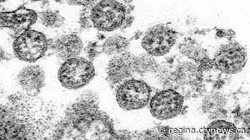 1 new COVID-19 case in Sask.; 172 cases active