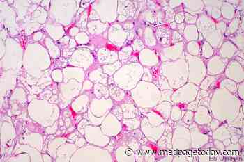 Benign or Malignant? No Way to Tell Radiologically