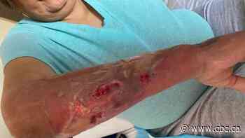 FSIN calls upon SHA for investigation after woman suffers alleged negligence