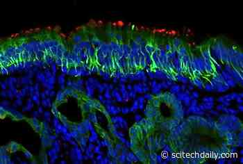 New Evidence That Cells in the Nose Are Key Entry Point for SARS CoV-2 / COVID-19