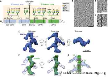 Architecture and function of human uromodulin filaments in urinary tract infections - Science Magazine