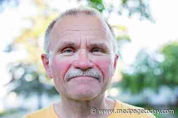 In Lupus, Older Age and Male Sex Raise Cancer Risk
