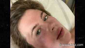 Ireland Baldwin Attacked by Crazed Woman on Drugs, Pics of Bruised Face