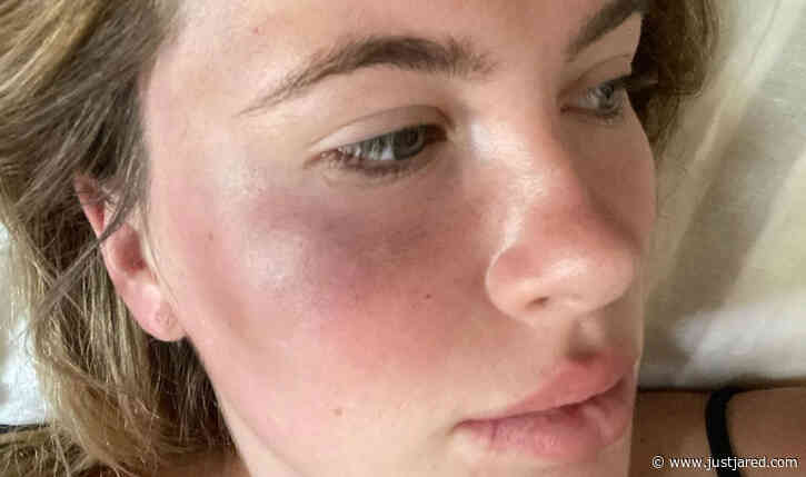 Ireland Baldwin Was Attacked & Robbed by Woman Who Was 'High Out of Her Mind'