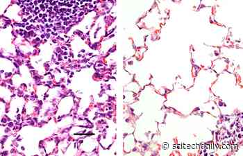 Single Dose of Nasal Vaccine Against COVID-19 Prevents Infection in Mice – Works Better Than Injection