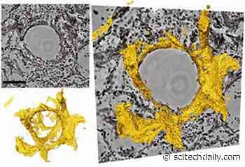 New 3D Imaging Technique to Visualize Lung Tissue Damage in Severe COVID-19