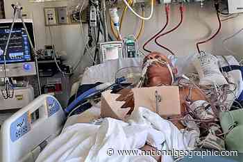 A fall shattered his body. These medical marvels pieced him back together. - National Geographic