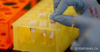 23rd coronavirus-related death reported in Saskatchewan, tests drop