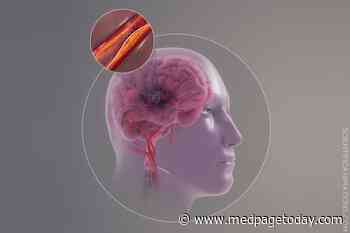 Cerebral Venous Thrombosis: Not Just a Young Woman's Disease Anymore