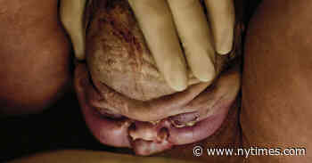 The Photographer Capturing Unvarnished Truths