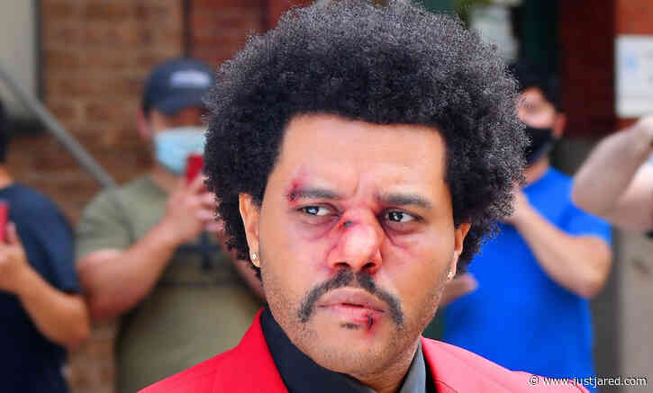 The Weeknd Steps Out with Bruised Face Makeup, Seemingly for VMAs Performance