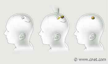 Elon Musk shows Neuralink brain link implant working in a pig     - CNET