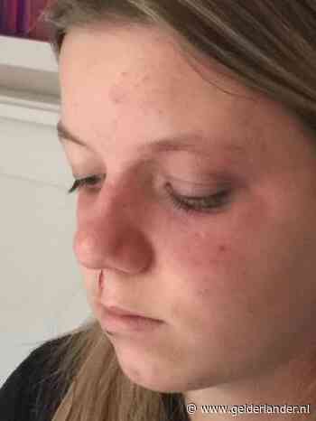 Jacky (14) slaapt slecht en is angstig na ernstige mishandeling: ‘Heel onwerkelijk’